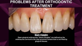 PROBLEMS AFTER ORTHODONTIC
TREATMENT
46
Black triangles
Open gingival embrasures “black triangles” are defined as the
embrasures cervical to the inter-proximal contact that is not filled by
gingival tissues.
 