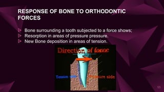 RESPONSE OF BONE TO ORTHODONTIC
FORCES
⩥ Bone surrounding a tooth subjected to a force shows;
⩥ Resorption in areas of pressure pressure.
⩥ New Bone deposition in areas of tension.
55
 