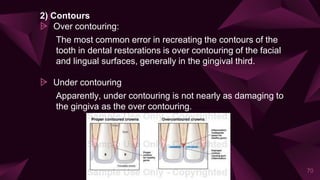 2) Contours
⩥ Over contouring:
The most common error in recreating the contours of the
tooth in dental restorations is over contouring of the facial
and lingual surfaces, generally in the gingival third.
⩥ Under contouring
Apparently, under contouring is not nearly as damaging to
the gingiva as the over contouring.
70
 