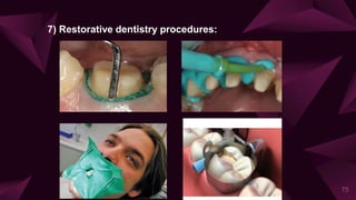 75
7) Restorative dentistry procedures:
 
