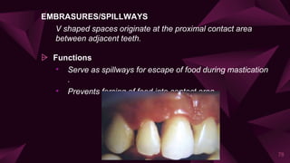 EMBRASURES/SPILLWAYS
V shaped spaces originate at the proximal contact area
between adjacent teeth.
⩥ Functions
• Serve as spillways for escape of food during mastication
.
• Prevents forcing of food into contact area.
78
 