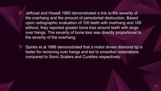 ⩥ Jeffcoat and Howell 1980 demonstrated a link to the severity of
the overhang and the amount of periodontal destruction. Based
upon radiographic evaluation of 100 teeth with overhang and 100
without, they reported greater bone loss around teeth with large
over hangs. The severity of bone loss was directly proportional to
the severity of the overhang.
⩥ Spinks et al 1986 demonstrated that a motor driven diamond tip is
faster for removing over hangs and led to smoother restorations
compared to Sonic Scalers and Curettes respectively.
80
 