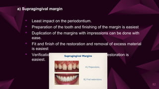 a) Supragingival margin
• Least impact on the periodontium.
• Preparation of the tooth and finishing of the margin is easiest
• Duplication of the margins with impressions can be done with
ease.
• Fit and finish of the restoration and removal of excess material
is easiest
• Verification of the marginal integrity of the restoration is
easiest.
82
 