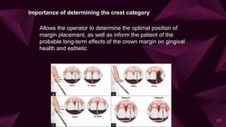 Importance of determining the crest category
Allows the operator to determine the optimal position of
margin placement, as well as inform the patient of the
probable long-term effects of the crown margin on gingival
health and esthetic
86
 