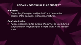 APICALLY POSITIONAL FLAP SURGERY
Indication
⩥ Crown lengthening of multiple teeth in a quadrant or
sextant of the dentition, root caries, fractures.
Contraindication
⩥ Apical repositioned flap surgery should not be used during
surgical crown lengthening of a single tooth in the esthetic
zone.
91
 