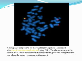 A metaphase cell positive for thebcr/abl rearrangement (associated
withchronic myelogenous leukemia) using FISH. The chromosomes can be
seen in blue. The chromosome that is labeled with green and red spots is the
one where the wrong rearrangement is present
 