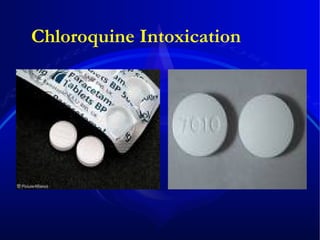 Chloroquine Intoxication 
