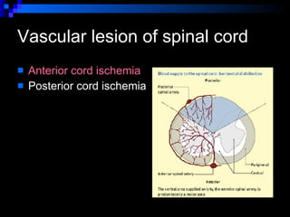 Vascular lesion of spinal cord  Anterior cord ischemia Posterior cord ischemia  