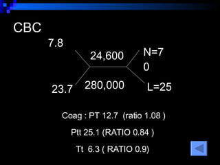 CBC  7.8  23.7  24,600  N=70  L=25  280,000 Coag : PT 12.7  (ratio 1.08 ) Ptt 25.1 (RATIO 0.84 )  Tt  6.3 ( RATIO 0.9)  