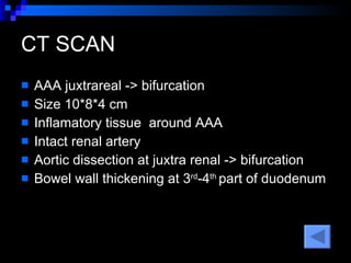 CT SCAN AAA juxtrareal -> bifurcation  Size 10*8*4 cm Inflamatory tissue  around AAA Intact renal artery Aortic dissection at juxtra renal -> bifurcation Bowel wall thickening at 3 rd -4 th  part of duodenum  