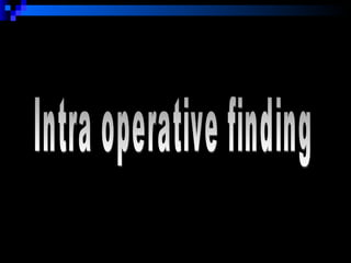 Intra operative finding 