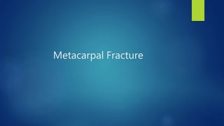 Metacarpal Fracture
 