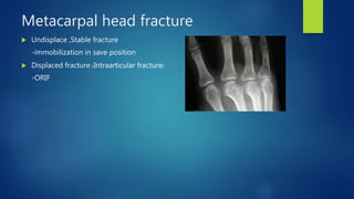 Metacarpal head fracture
 Undisplace ,Stable fracture
-immobilization in save position
 Displaced fracture (Intraarticular fracture)
-ORIF
 