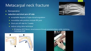 Metacarpal neck fracture
 Nonoperative
 reduction and short arm AP slab
 acceptable degrees of apex dorsal angulation
 immobilize safe position include PIP joint
 Short arm AP slab for 3 weeks
 reduce using Jahss technique
 90 degrees MCP flexion, dorsal pressure through proximal phalanx while stabilizing
metacarpal shaft
 
