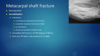 Metacarpal shaft fracture
 Nonoperative
 immobilization
 indications
 nondisplaced metacarpal neck fractures
 acceptable angulation (see above table)
 no malrotation
 shortening (aesthetic problem only)
 immobilize MCP joints in 70-90 degrees of flexion
 Short arm AP slab in safe position for 3 weeks
 