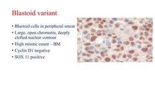 Lymphoma spillover.pptx
