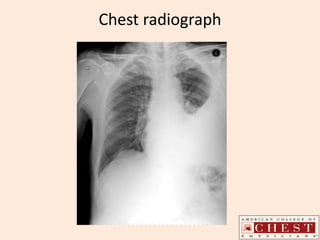 Chest radiograph
 