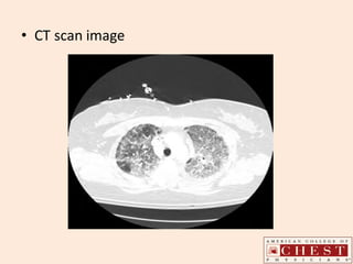 • CT scan image
 