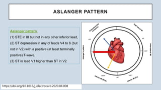 INTERESTING ECGS -- PART II | PPTX