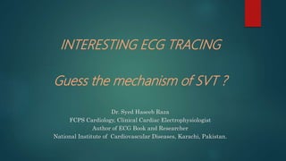 INTERESTING ECG TRACING
Guess the mechanism of SVT ?
Dr. Syed Haseeb Raza
FCPS Cardiology, Clinical Cardiac Electrophysiologist
Author of ECG Book and Researcher
National Institute of Cardiovascular Diseases, Karachi, Pakistan.
 