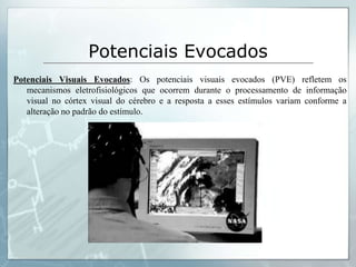 Potenciais Evocados
Potenciais Visuais Evocados: Os potenciais visuais evocados (PVE) refletem os
   mecanismos eletrofisiológicos que ocorrem durante o processamento de informação
   visual no córtex visual do cérebro e a resposta a esses estímulos variam conforme a
   alteração no padrão do estímulo.
 