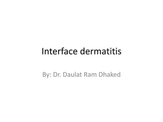 Interface dermatitis
By: Dr. Daulat Ram Dhaked

 