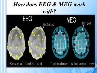 How does EEG & MEG work 
with? 
 