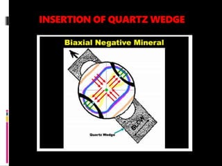 INSERTION OF QUARTZ WEDGE
 