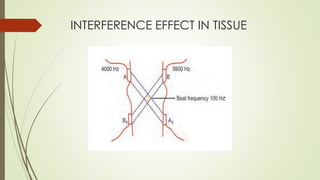 Interferential therapy | PDF