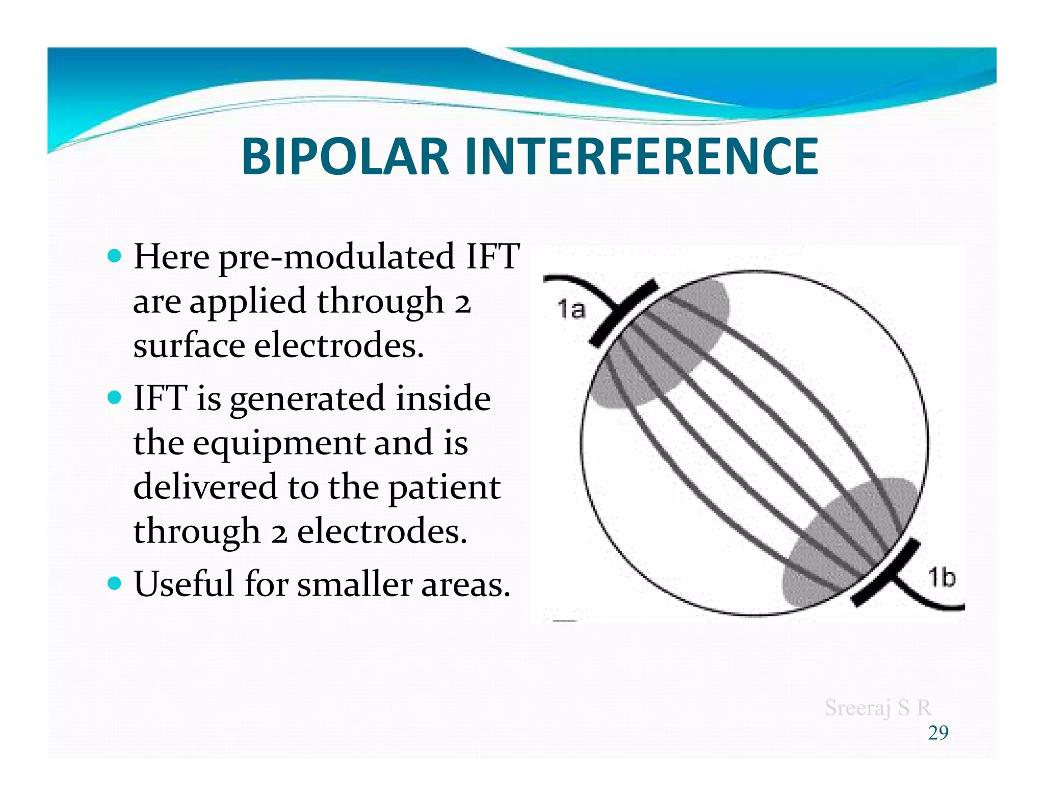 Interferential therapy | PDF