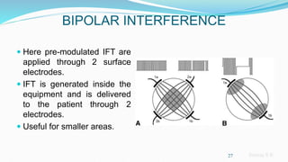 Sreeraj S R
BIPOLAR INTERFERENCE
 Here pre-modulated IFT are
applied through 2 surface
electrodes.
 IFT is generated inside the
equipment and is delivered
to the patient through 2
electrodes.
 Useful for smaller areas.
27
 