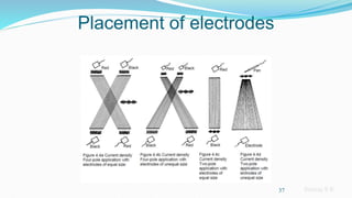 Sreeraj S R
Placement of electrodes
37
 