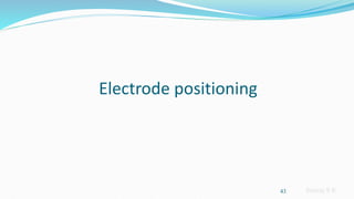 Sreeraj S R
Electrode positioning
43
 