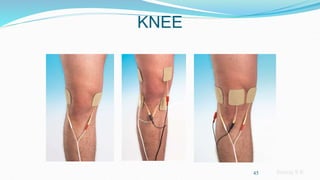 Sreeraj S R
KNEE
45
 