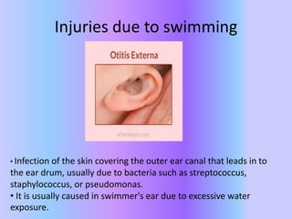 Injuries due to swimming
• Infection of the skin covering the outer ear canal that leads in to
the ear drum, usually due to bacteria such as streptococcus,
staphylococcus, or pseudomonas.
• It is usually caused in swimmer's ear due to excessive water
exposure.
 