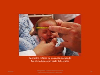 Perímetro cefálico de un recién nacido de
Brasil medido como parte del estudio
Amanzo
Intergrowth: Estándar Internacional de
Crecimiento Intrauterino y Neonatal
56
 