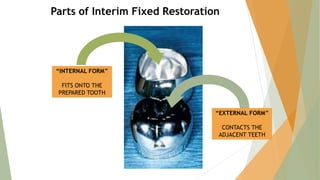Parts of Interim Fixed Restoration
“INTERNAL FORM”
FITS ONTO THE
PREPARED TOOTH
“EXTERNAL FORM”
CONTACTS THE
ADJACENT TEETH
 