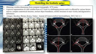 • Obtaining vertebra dimensions from computer tomography (CT) scans.
• A precise segmentation of a full vertebra from a CT scan is a challenging process and it is affected by various factors
such as: complex anatomical structure, unclear object boundaries, similar structures in near vicinity and degenerative
deformities
• (images: Akyokus, Meram, Konya, Turkey : Journal of Craniovertebral Junction&Spine, 2015, Vol. 6. )
Modelling the Scoliotic spine:
 