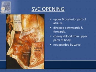 SVC OPENING
• upper & posterior part of
atrium.
• directed downwards &
forwards.
• conveys blood from upper
parts of body.
• not guarded by valve
 