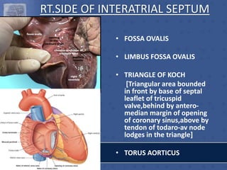 RT.SIDE OF INTERATRIAL SEPTUM
• FOSSA OVALIS
• LIMBUS FOSSA OVALIS
• TRIANGLE OF KOCH
[Triangular area bounded
in front by base of septal
leaflet of tricuspid
valve,behind by antero-
median margin of opening
of coronary sinus,above by
tendon of todaro-av node
lodges in the triangle]
• TORUS AORTICUS
 