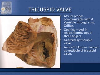 TRICUSPID VALVE
• Atrium proper
communicates with rt.
Ventricle through rt av.
Orifice.
• Opening – oval in
shape.Permits tips of
three fingers.
• Guarded by tricuspid
valve.
• Area of rt.Atrium - known
as vestibule of tricuspid
valve.
 