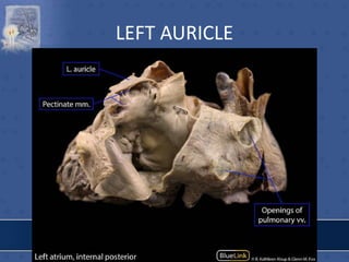 LEFT AURICLE
 