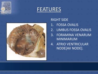 FEATURES
RIGHT SIDE
1. FOSSA OVALIS
2. LIMBUS FOSSA OVALIS
3. FORAMINA VENARUM
MINIMARUM
4. ATRIO VENTRICULAR
NODE[AV NODE].
 