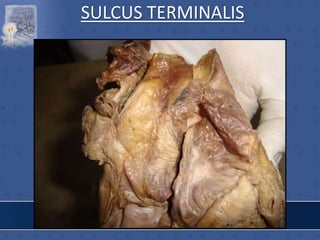 SULCUS TERMINALIS
 