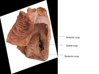 Anterior cusp
Septal cusp
Posterior cusp
 