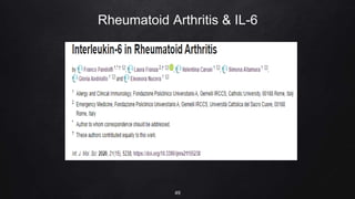 Rheumatoid Arthritis & IL-6
49
 