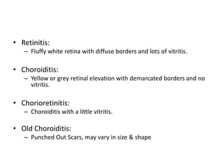 Diffuse Borders Intermeddiate & posterior uveitis dr.k.srikanth, 23.03.2016 revised | PPTX