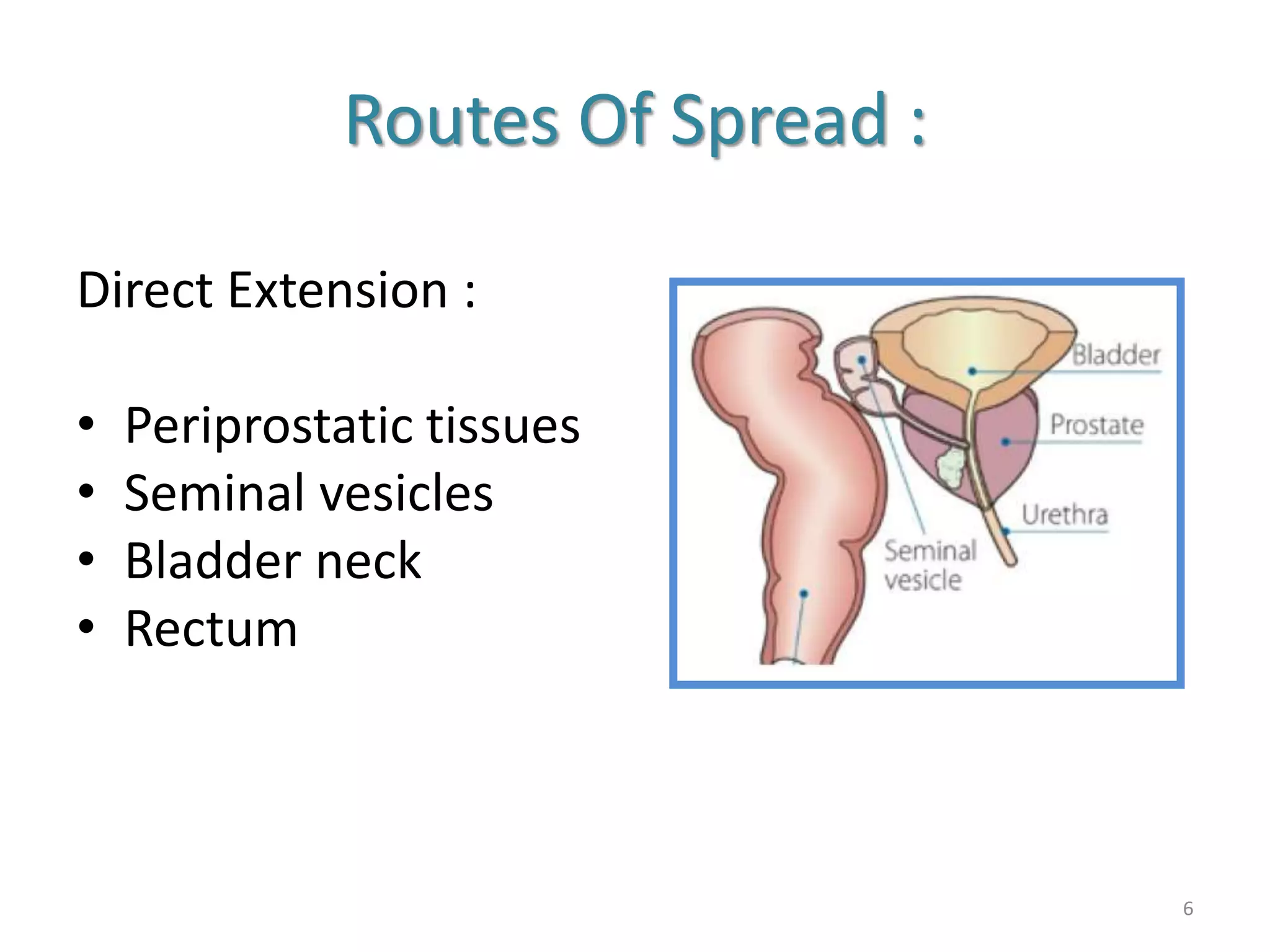 The Mechanics of Spread: Direct Extension The Mechanics of Spread: Direct Extension