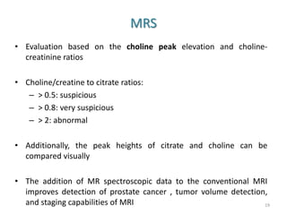Intermediate and high risk prostate cancer | PPTX