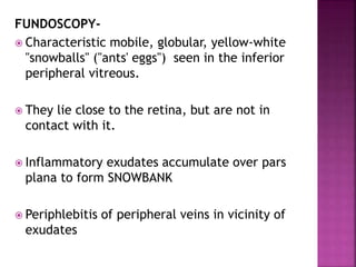 FUNDOSCOPY-
 Characteristic mobile, globular, yellow-white
"snowballs" ("ants' eggs") seen in the inferior
peripheral vitreous.
 They lie close to the retina, but are not in
contact with it.
 Inflammatory exudates accumulate over pars
plana to form SNOWBANK
 Periphlebitis of peripheral veins in vicinity of
exudates
 